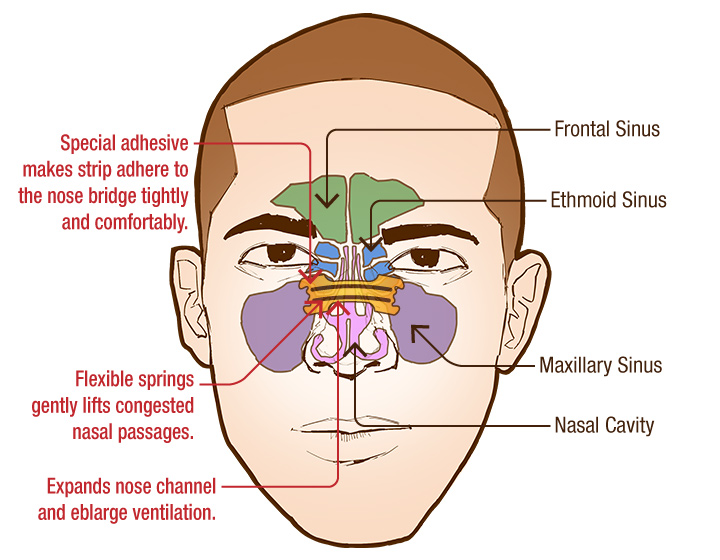 How Do Nasal Strips Work?