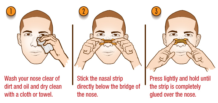 do nasal strips work for sleep apnea