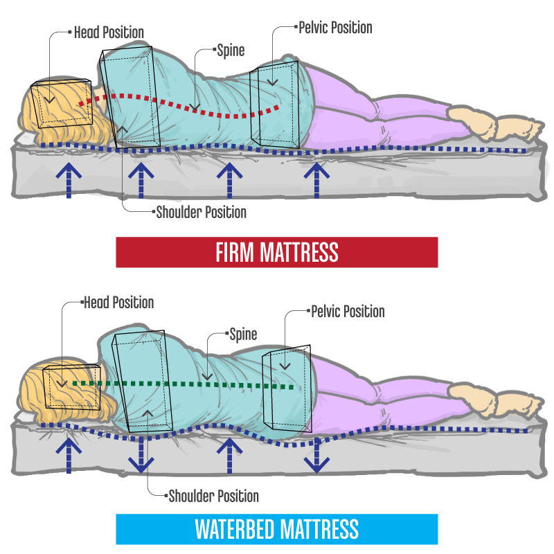 Waterbeds Improper Sleeping Alignment